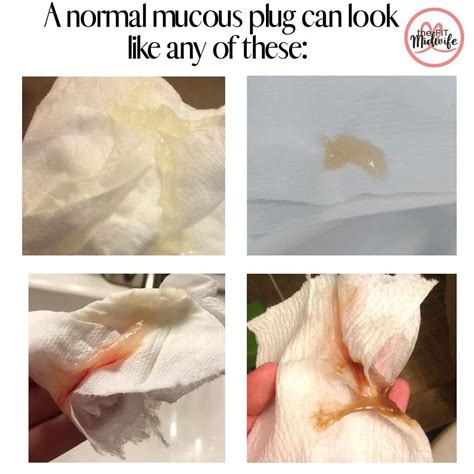 dilated mucus plug color chart|What does the mucus plug look like compared to other discharge ...